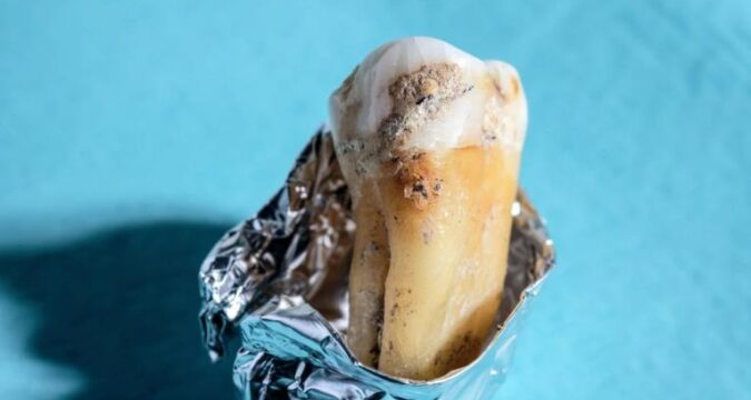 Bacterias dentales