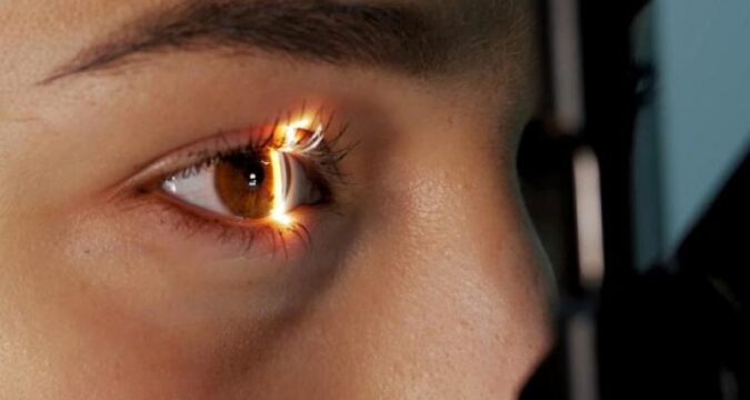 cornea artificial
